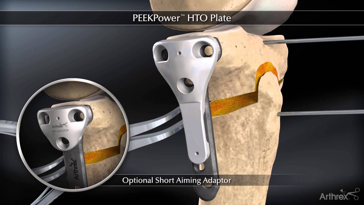 maxresdefault1 Lynch Medical Supplies